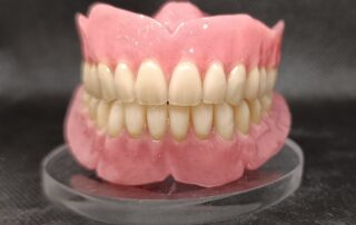 prótesis removibles vs fijas