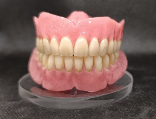 Prótesis removibles vs fijas: ventajas y desventajas de cada opción