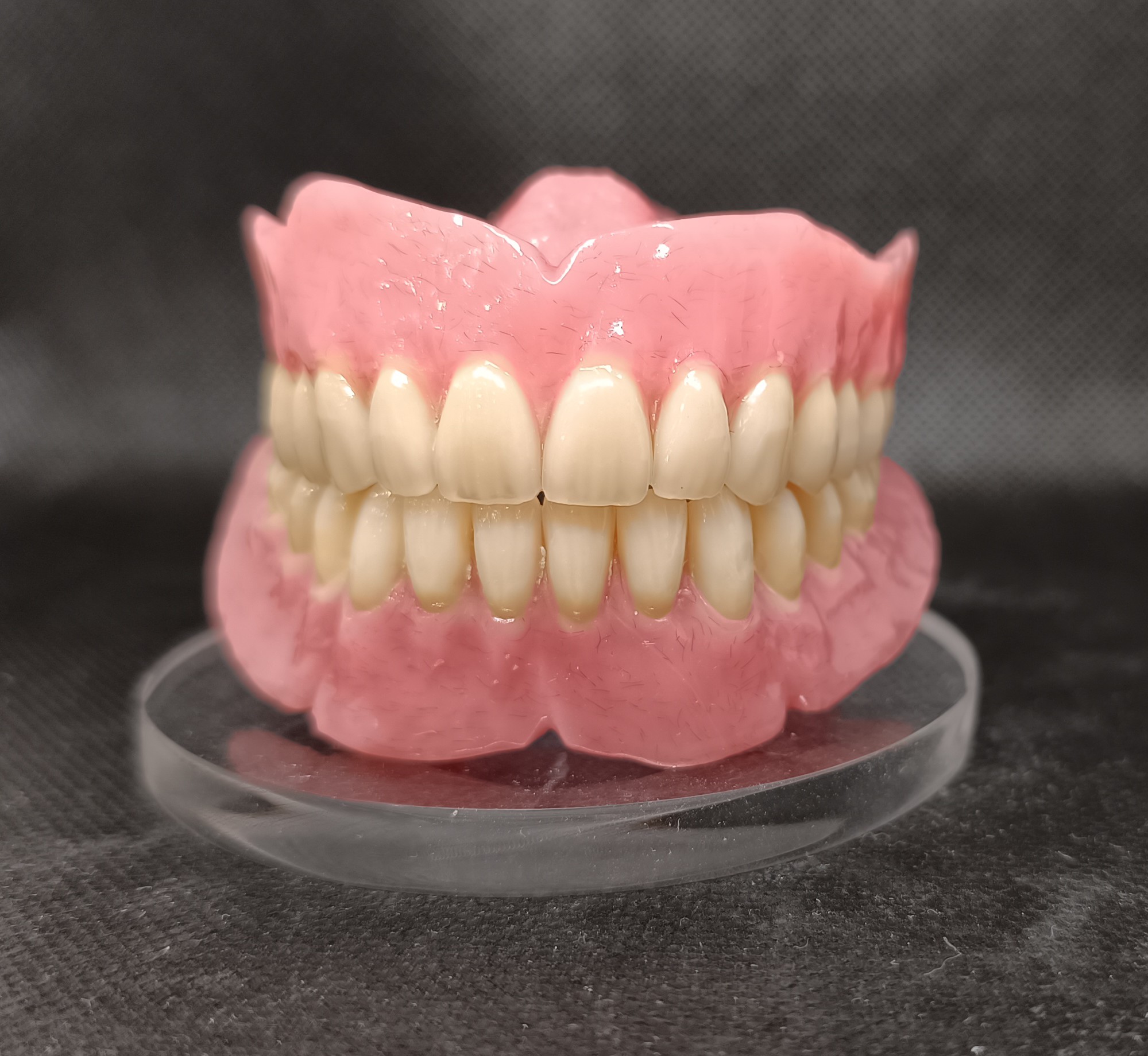 prótesis removibles vs fijas