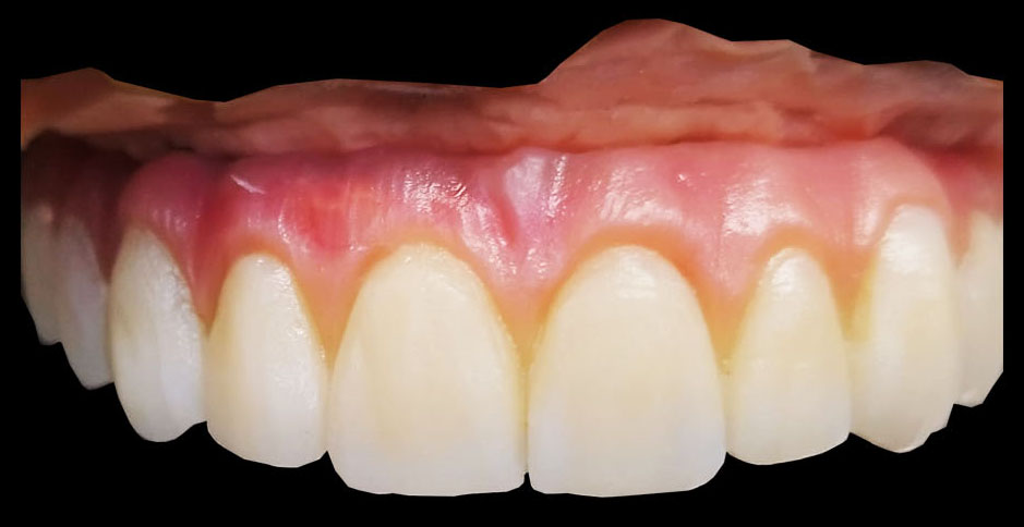 Hibrida-slider-inicio