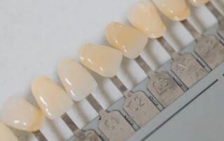 prótesis Composite Híbrido