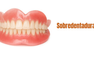 sobredentaduras personalizadas